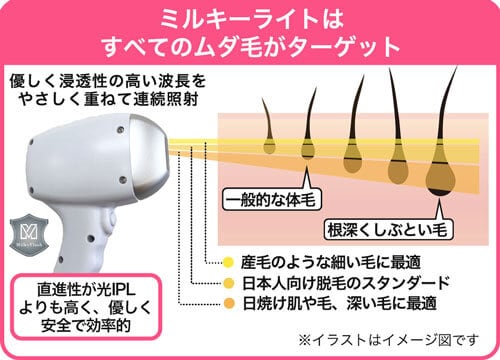 ミルキーライトはすべてのムダ毛がターゲット（脱毛の仕組み解説図）